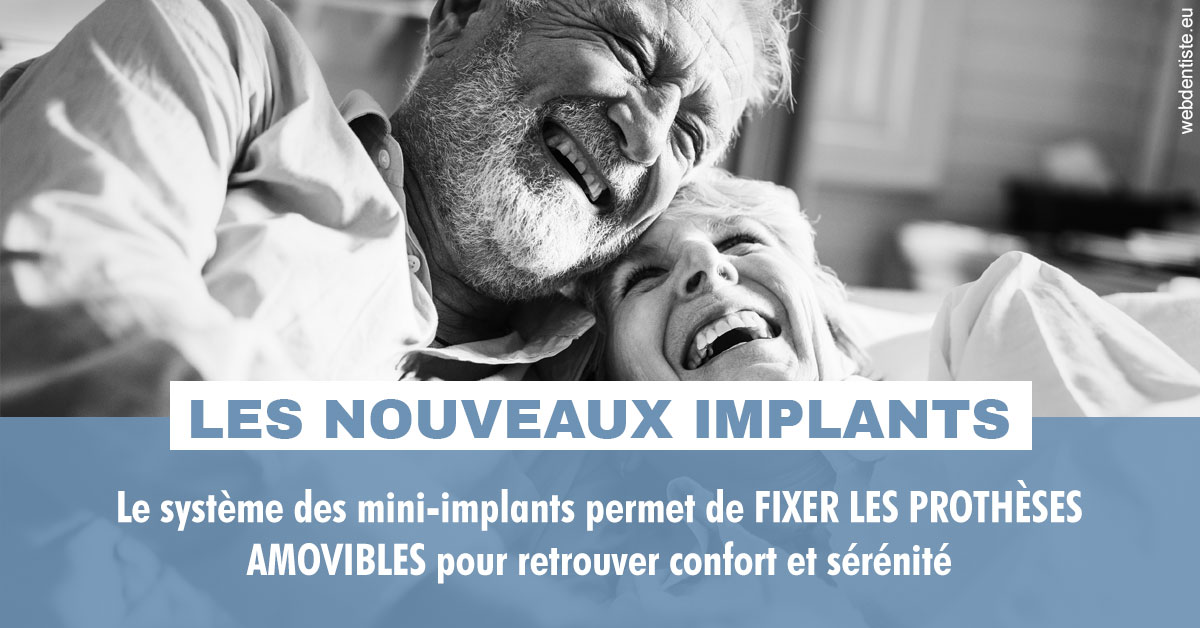 https://dr-allouche-laurent.chirurgiens-dentistes.fr/Les nouveaux implants 2