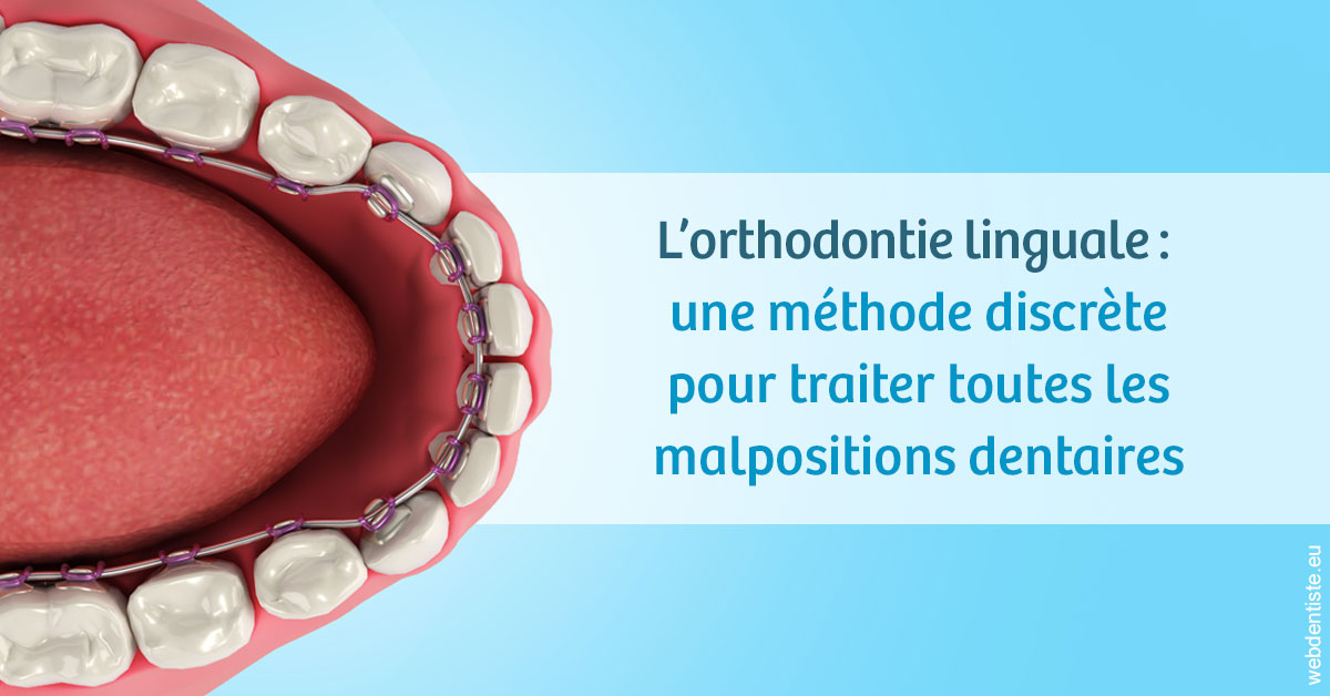 https://dr-allouche-laurent.chirurgiens-dentistes.fr/L'orthodontie linguale 1