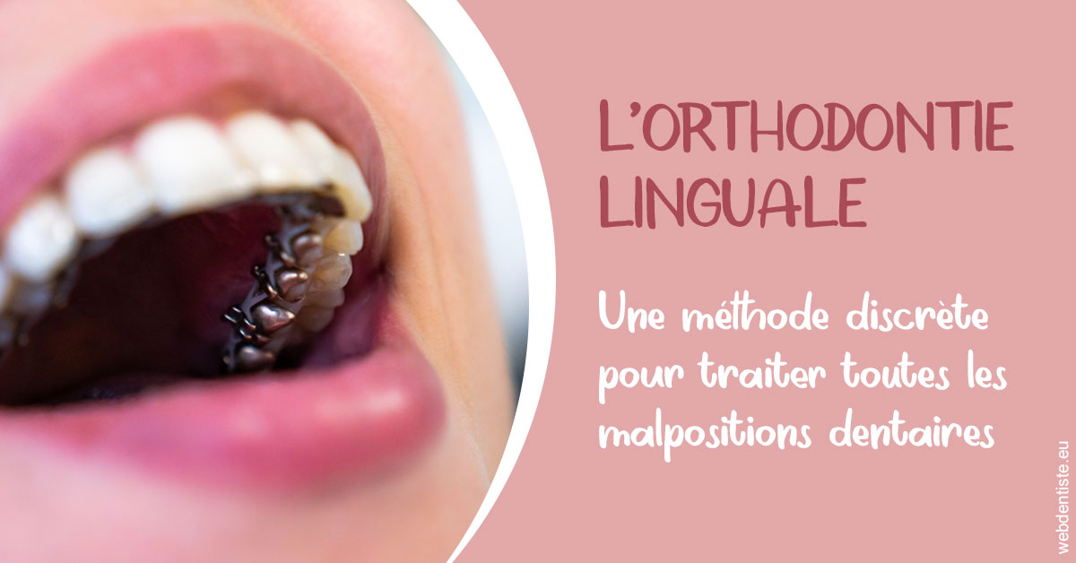 https://dr-allouche-laurent.chirurgiens-dentistes.fr/L'orthodontie linguale 2