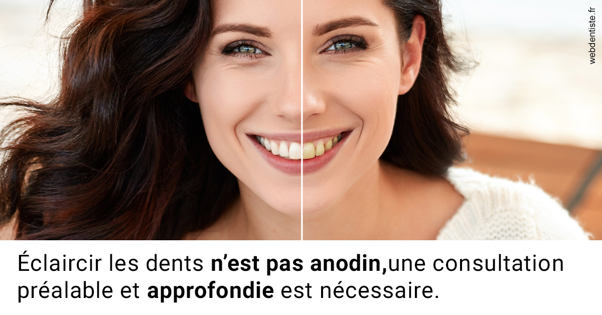 https://dr-allouche-laurent.chirurgiens-dentistes.fr/Le blanchiment 2