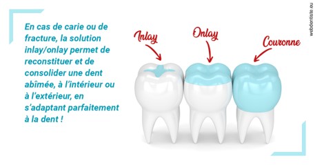 https://dr-allouche-laurent.chirurgiens-dentistes.fr/L'INLAY ou l'ONLAY