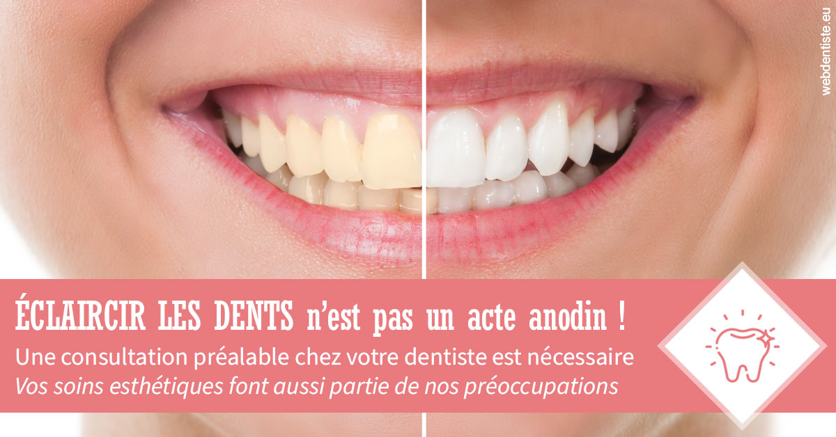 https://dr-allouche-laurent.chirurgiens-dentistes.fr/Eclaircir les dents 1