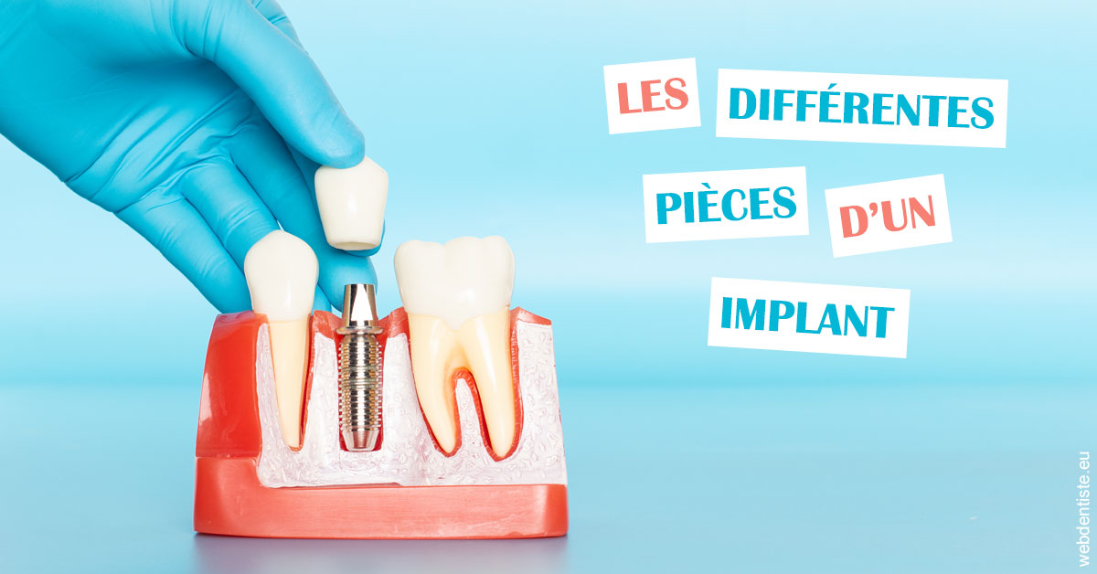 https://dr-allouche-laurent.chirurgiens-dentistes.fr/Les différentes pièces d’un implant 2