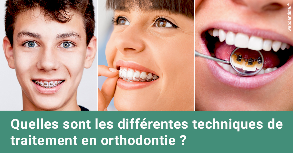 https://dr-allouche-laurent.chirurgiens-dentistes.fr/Les différentes techniques de traitement 2