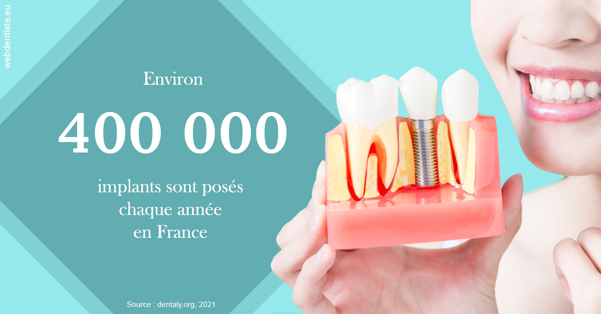 https://dr-allouche-laurent.chirurgiens-dentistes.fr/Pose d'implants en France 2