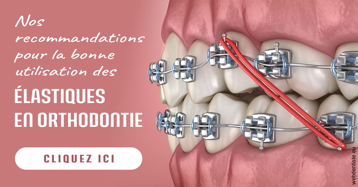 https://dr-allouche-laurent.chirurgiens-dentistes.fr/Elastiques orthodontie 2
